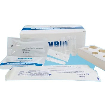 Prova rinofaringea dell'antigene del tampone di SARS-Cov-2 Rtk