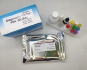 Antigene Elisa Home Test Kit del centro del virus dell'epatite B 96 pezzi di alta efficienza