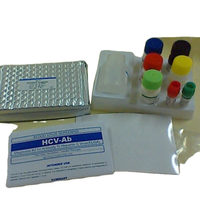 Interleuchina 1 beta corredo Il1b umano Elisa Kit Reaserch Use di rilevazione di elisa